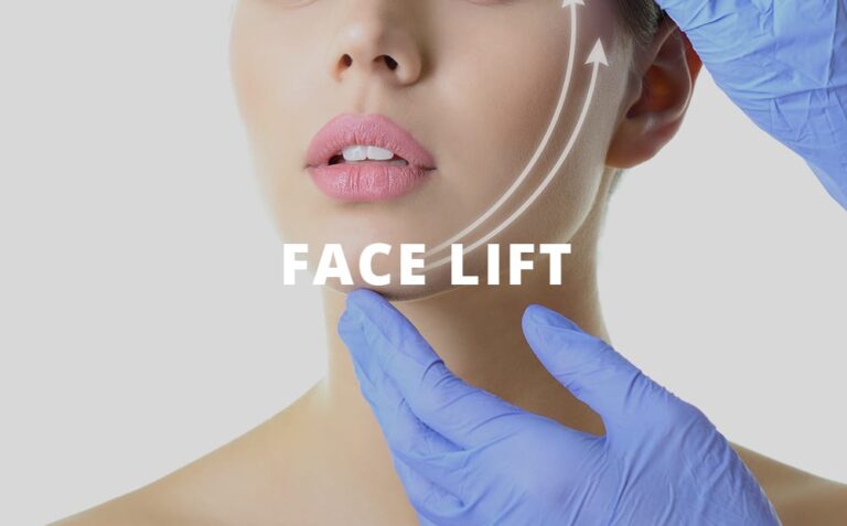 Facelift Trends Among Celebrities In Dubai: Insights And Influences!