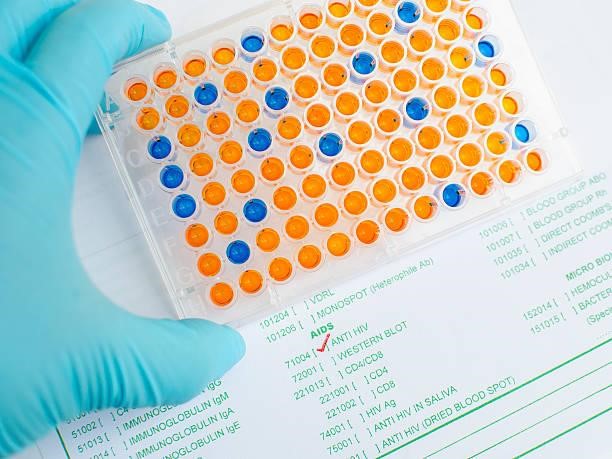<strong>What You Should Know About ELISA Kits</strong> 